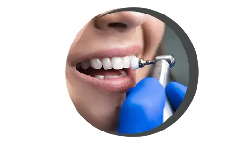 Dental Cleaning Dental cleaning, Teeth cleaning, Professional dental cleaning