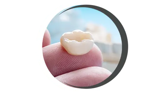 Dental crown, Dental cap for tooth, Tooth restoration crown