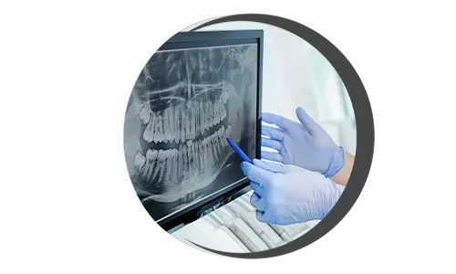 Dental Exam & Xray Dental exam x-ray, Dental checkup x-ray, Oral exam and radiographs