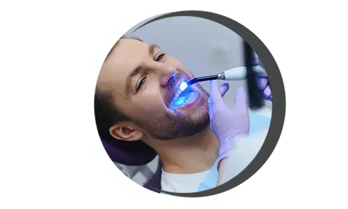 Dental Fillings Dental filling, Tooth filling options, Composite amalgam restoration