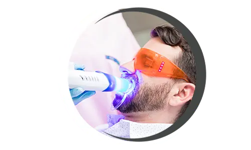 Dental Teeth Whitening Teeth whitening, Brightening teeth, Tooth bleaching