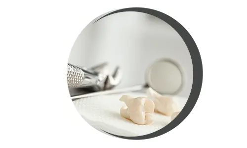 Dental Tooth Extraction Tooth extraction, Removing a tooth, Dental extraction procedure